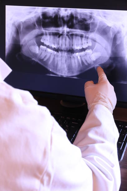 Best Dentist for Tooth Abscess  in Melrose, MA